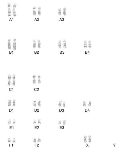 caryotype du chat